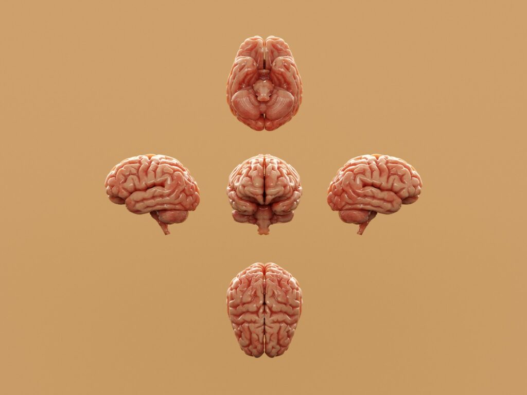 Various perspectives of a human brain are displayed.
